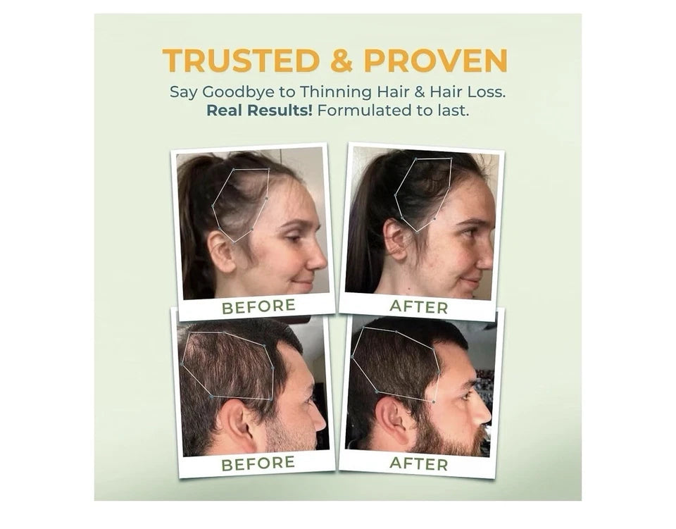 Vitalyra Hair Complex Hair Growth Healthy Skin Nails For Women &Men 60 Capsules