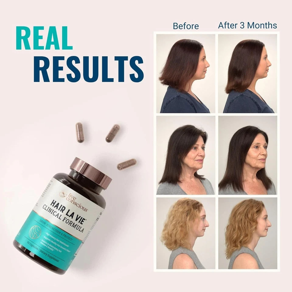 Hair La Vie Clinical Formula Hair Vitamins for Hair Regrowth, 90 Caps
